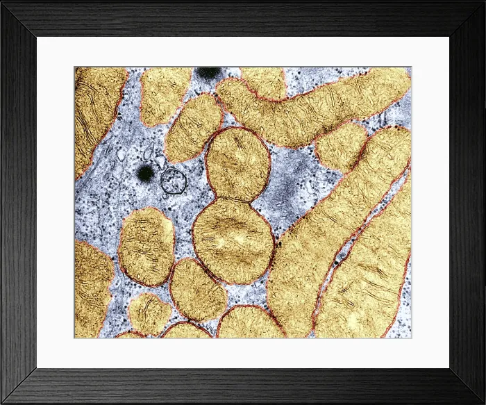Framed Print : Dividing Mitochondrion, TEM Framed Print : Dividing Mitochondrion, TEM