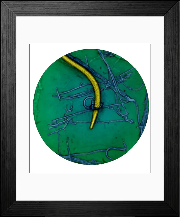 Framed Print : Nematode Snared by Predatory Fungus (LM) under a microscope