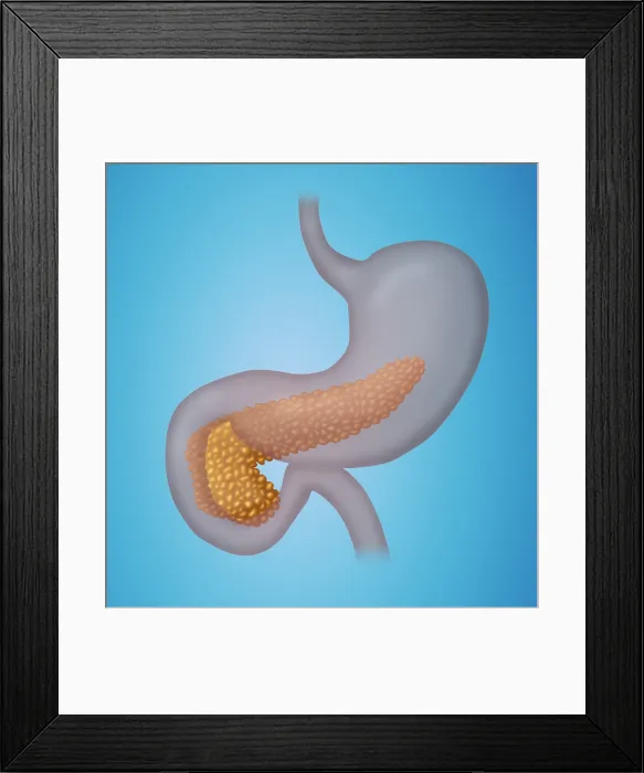 Framed Print : Pancreas. Illustration of a human pancreas within the stomach