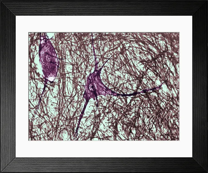 Framed Print : Motor Neuron, TEM Framed Print : Motor Neuron, TEM