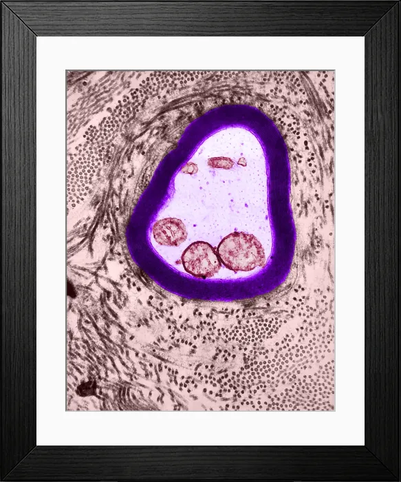 Framed Print : Nervous System, Myelinated Axon, TEM