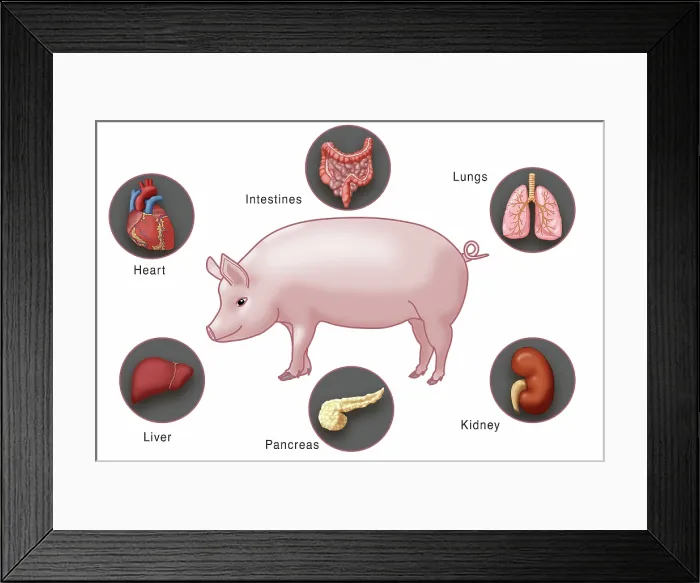 Framed Print : Genetically modified pig and human organs for Xenotransplantation, intestines, lungs, kidney, pancreas, liver and heart, medical illustration Framed Print : Genetically modified pig and human organs for Xenotransplantation, intestines, lungs, kidney, pancreas, liver and heart, medical illustration