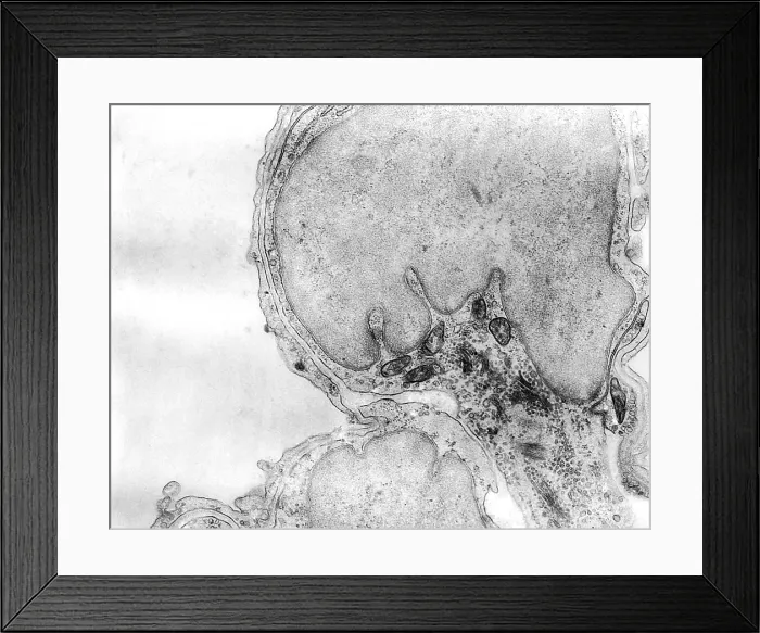 Framed Print : Alveolar capillary Framed Print : Alveolar capillary
