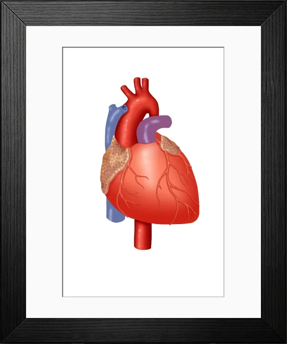 Framed Print : Human Heart Framed Print : Human Heart