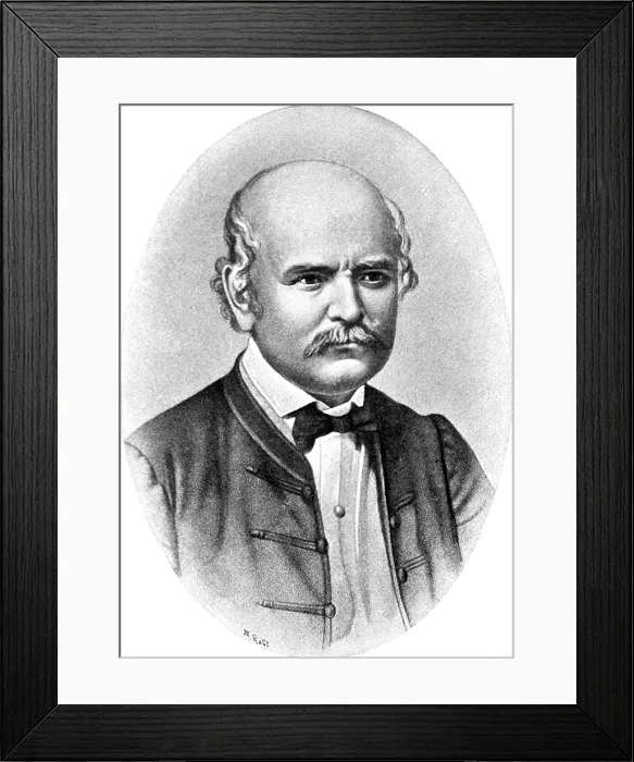 Framed Print : Ignaz Semmelweis, Hungarian Obstetrician Framed Print : Ignaz Semmelweis, Hungarian Obstetrician