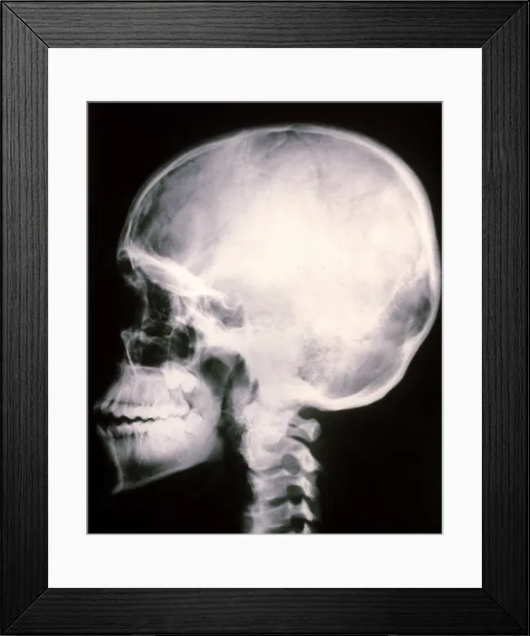 Framed Print : Human Skull