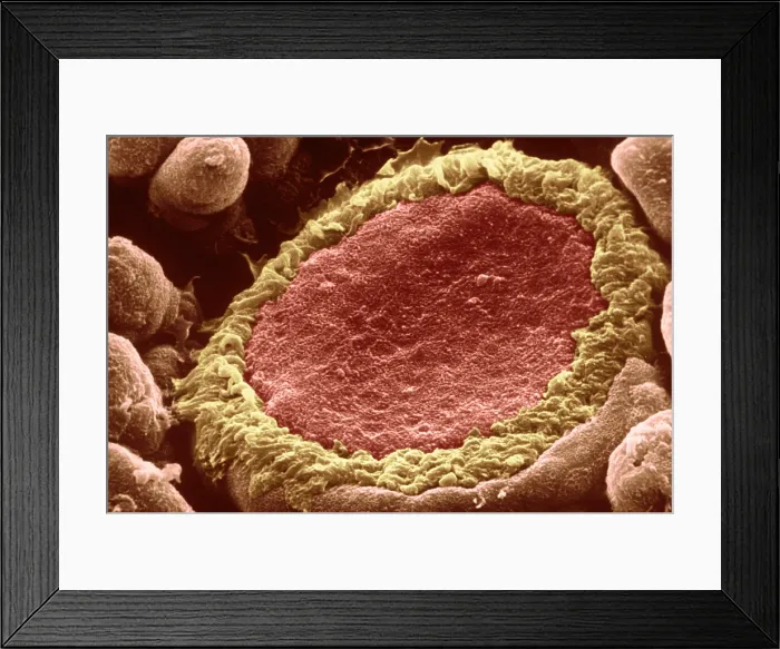 Framed Print : Taste bud. Color enhanced electron micrograph of taste buds; groups of Framed Print : Taste bud. Color enhanced electron micrograph of taste buds; groups of