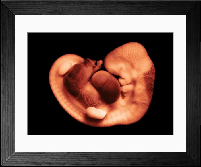 Framed Print : 35 day old human embryo Framed Print : 35 day old human embryo