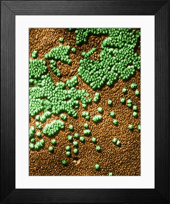 Framed Print : Hepatitis Virus Framed Print : Hepatitis Virus
