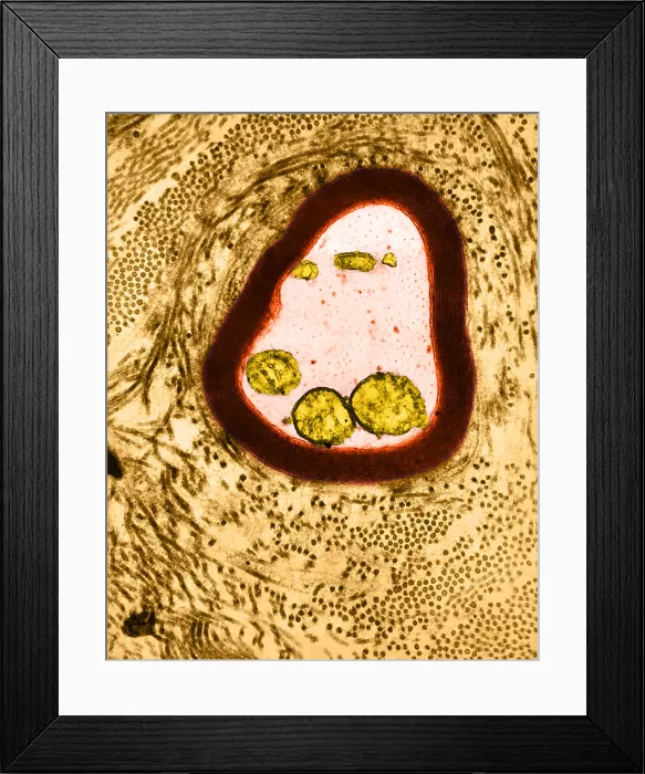 Framed Print : Nervous System, Myelinated Axon, TEM Framed Print : Nervous System, Myelinated Axon, TEM