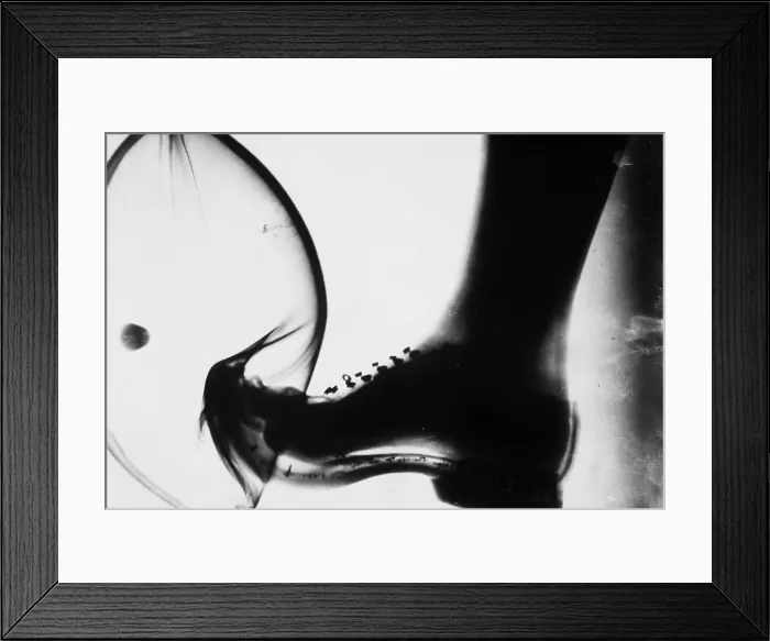 Framed Print : Kicking a Ball, X-ray Framed Print : Kicking a Ball, X-ray