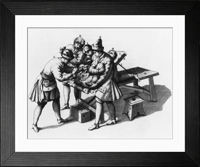Framed Print : Lithotomy, 1707 Framed Print : Lithotomy, 1707