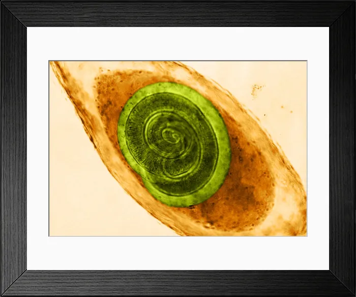 Framed Print : Trichinella in Muscle (LM) under a microscope Framed Print : Trichinella in Muscle (LM) under a microscope