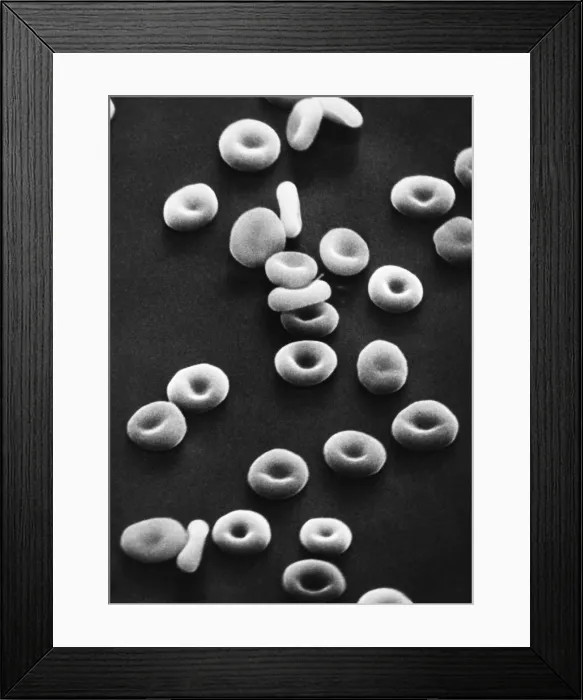 Framed Print : Red Blood Cells, under a microscope (SEM) Framed Print : Red Blood Cells, under a microscope (SEM)
