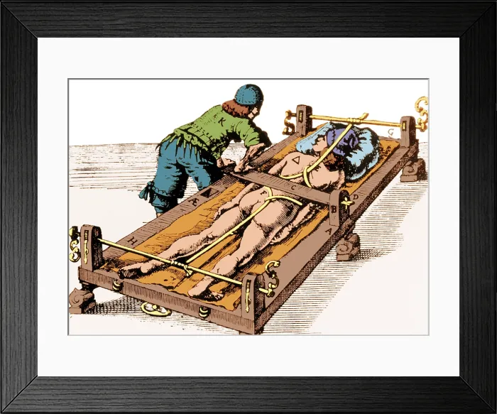 Framed Print : Avicenna Spinal Deformity Correction Method Framed Print : Avicenna Spinal Deformity Correction Method