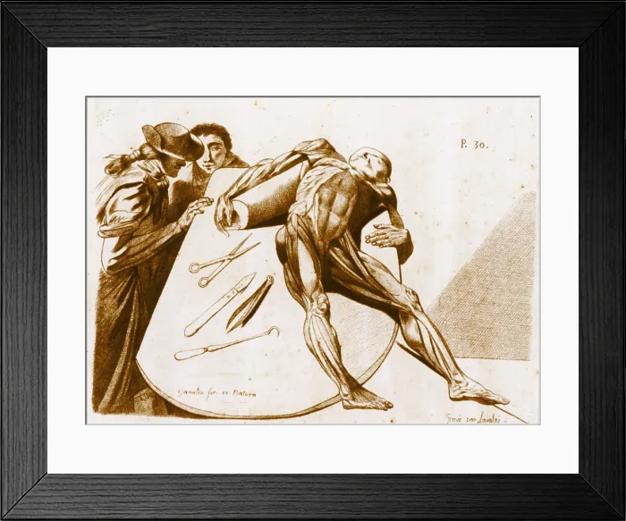 Framed Print : Contemplating a Cadaver