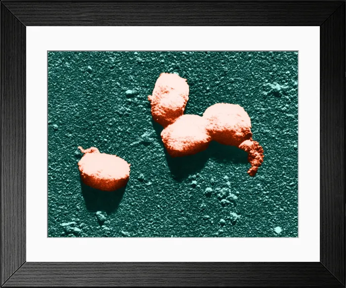 Framed Print : Vaccinia Virus, Eradicated Smallpox, TEM