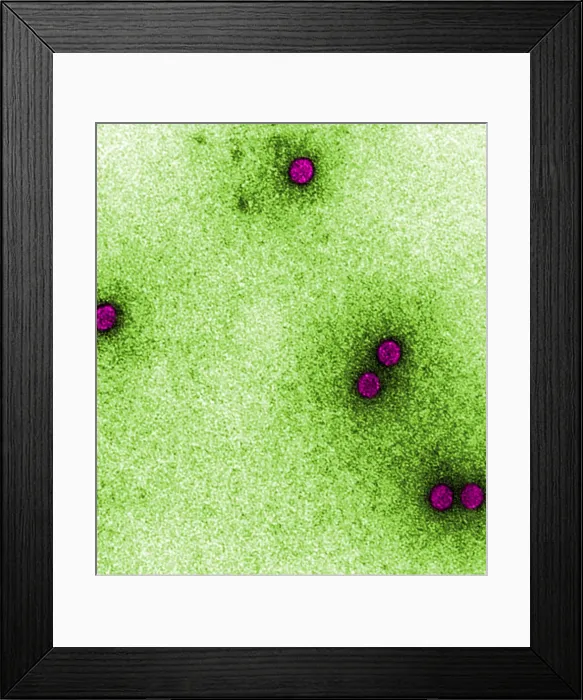 Framed Print : TEM of Rhinoviruses Framed Print : TEM of Rhinoviruses