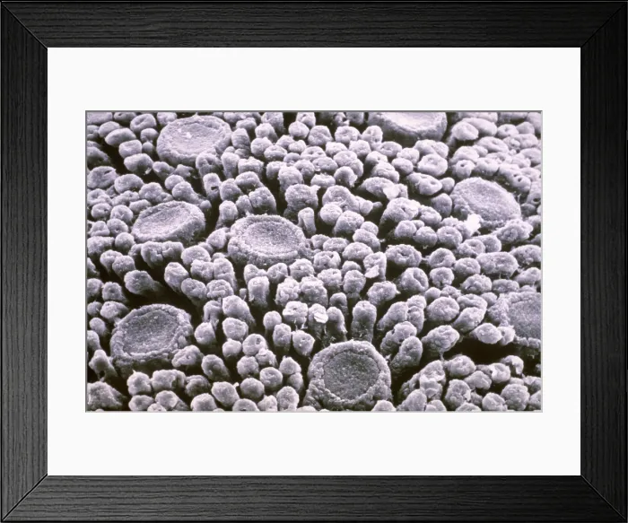 Framed Print : Tastebuds. Scanning electron microscopy of taste buds on the surface of a tongue Framed Print : Tastebuds. Scanning electron microscopy of taste buds on the surface of a tongue