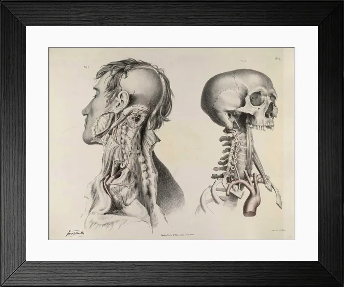 Framed Print : Historical Anatomical Illustration Framed Print : Historical Anatomical Illustration