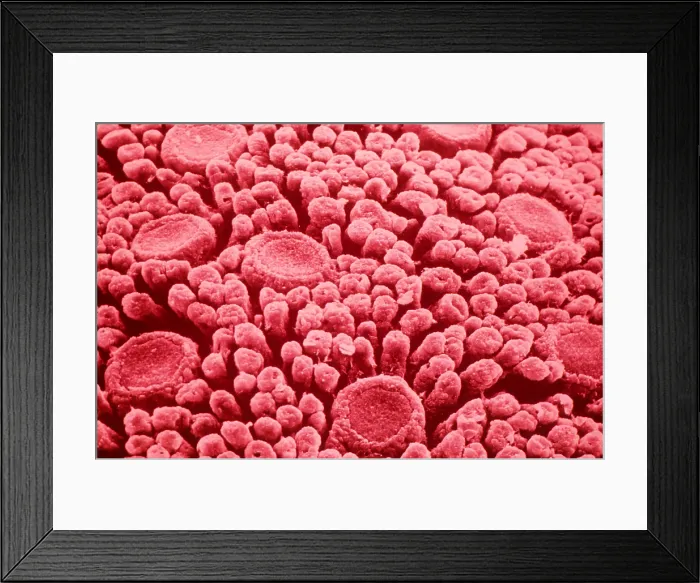 Framed Print : Taste Buds or papillae of the tongue under a microscope (SEM) Framed Print : Taste Buds or papillae of the tongue under a microscope (SEM)
