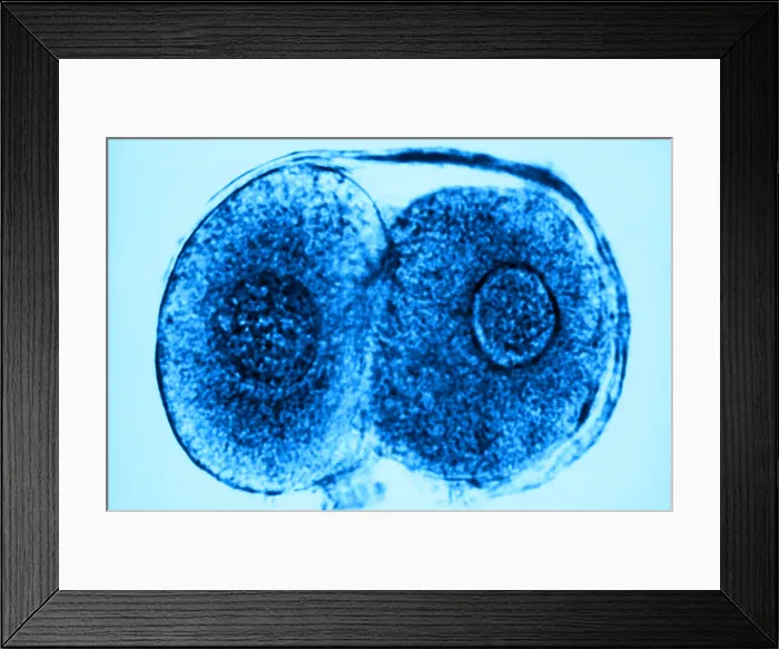 Framed Print : Human Reproduction, Ovum, Zygote Cell Stage, TEM