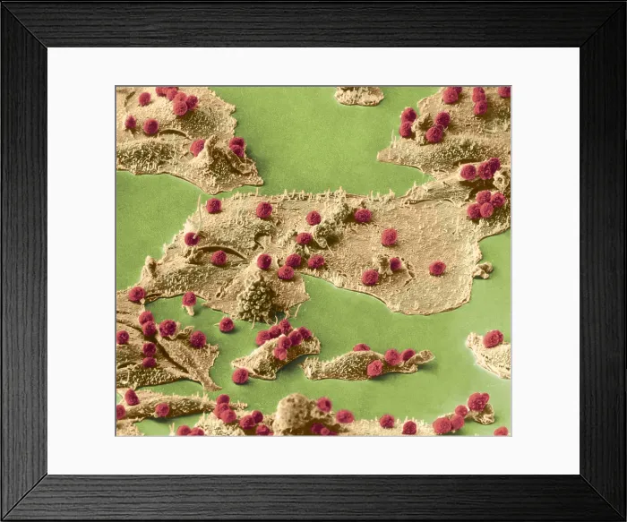 Framed Print : Immune Cells Attacking Cancer Cells, under a microscope (SEM) Framed Print : Immune Cells Attacking Cancer Cells, under a microscope (SEM)