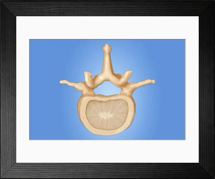 Framed Print : Lumbar Vertebra
