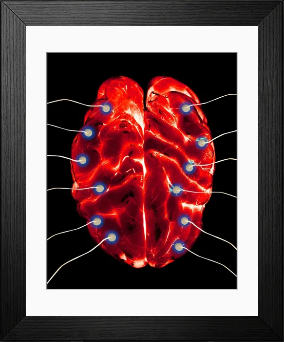 Framed Print : Brain EEG. Illustration of a brain undergoing an EEG (electroencephalogram) Framed Print : Brain EEG. Illustration of a brain undergoing an EEG (electroencephalogram)