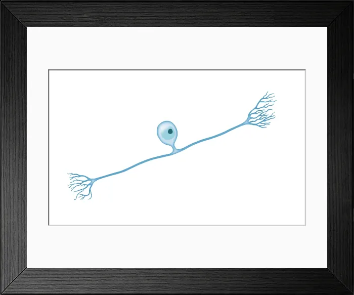 Framed Print : Pseudounipolar Neuron Framed Print : Pseudounipolar Neuron