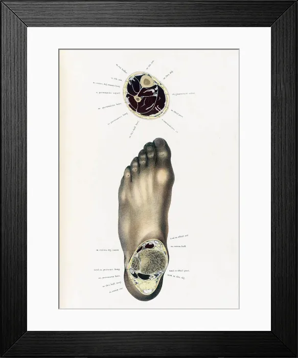 Framed Print : Topographisch-anatomischer, Braune, 1872