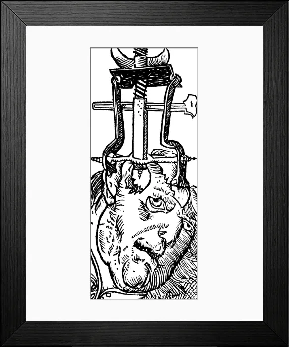 Framed Print : Trepanning, 1525 Framed Print : Trepanning, 1525