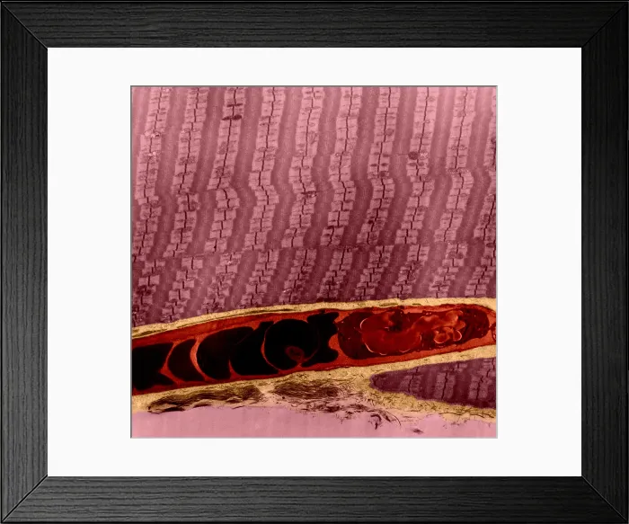 Framed Print : Capillary Between Muscle Fibers, TEM Framed Print : Capillary Between Muscle Fibers, TEM