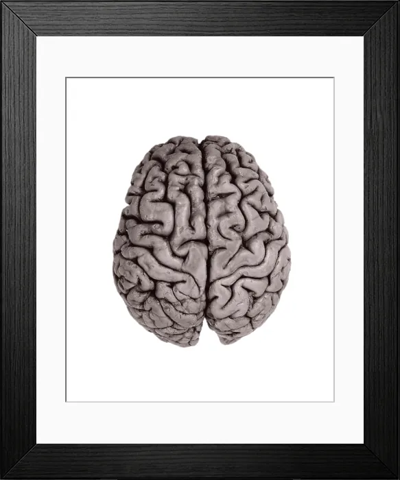 Framed Print : Human Brain, gross specimen Framed Print : Human Brain, gross specimen
