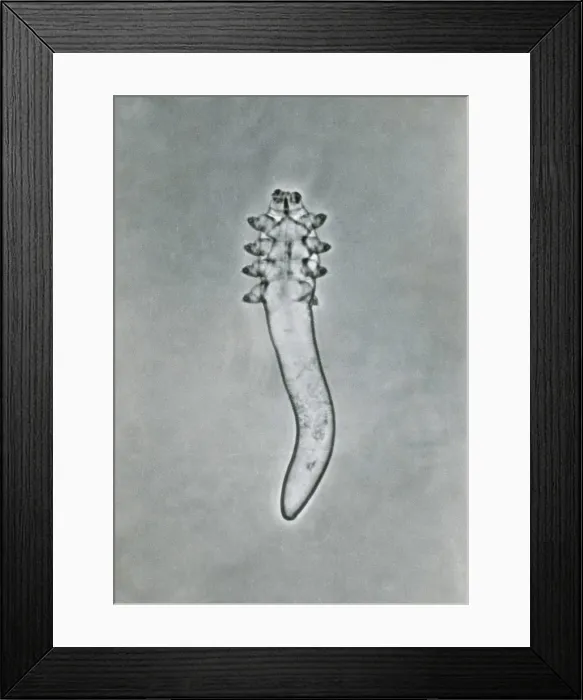 Framed Print : Mite (Demodex folliculorum) under a microscope Framed Print : Mite (Demodex folliculorum) under a microscope