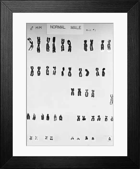 Framed Print : Karyotype, Normal Male Chromosomes Framed Print : Karyotype, Normal Male Chromosomes