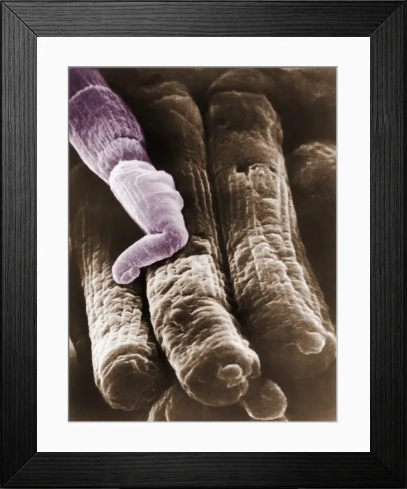 Framed Print : Rods and Cones
