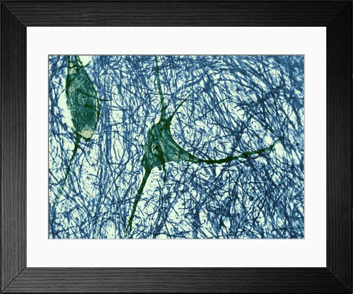 Framed Print : Motor Neuron, TEM Framed Print : Motor Neuron, TEM