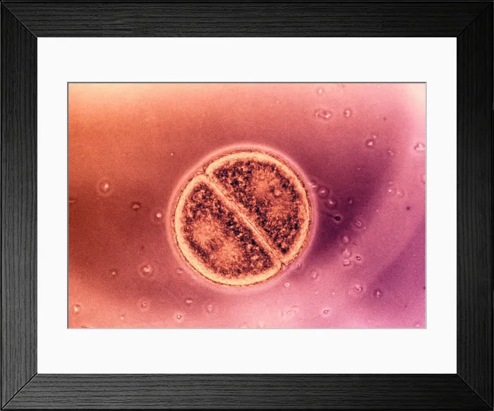 Framed Print : Cell Division in Arbacia Punctulata