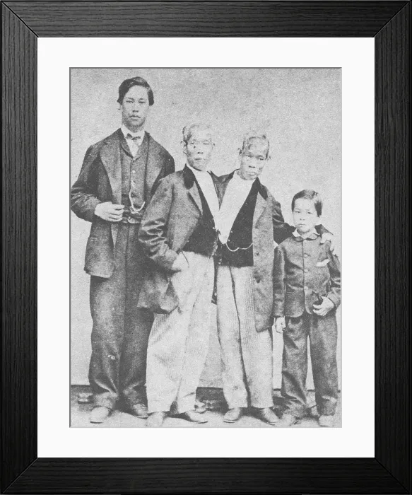 Framed Print : Chang and Eng, Original Siamese Twins Framed Print : Chang and Eng, Original Siamese Twins
