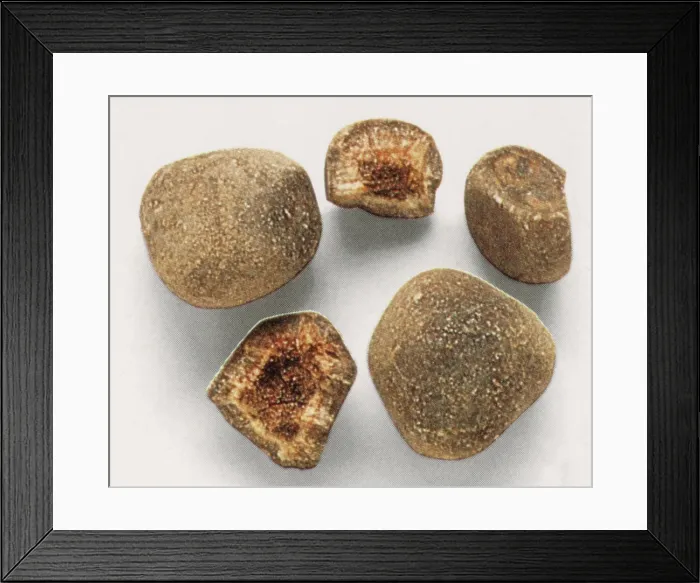 Framed Print : Bezoar Stones, Medieval Antidote for Poisoning, gross specimen Framed Print : Bezoar Stones, Medieval Antidote for Poisoning, gross specimen