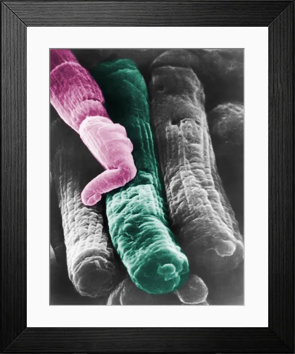 Framed Print : Rods and Cones, under a microscope (SEM)