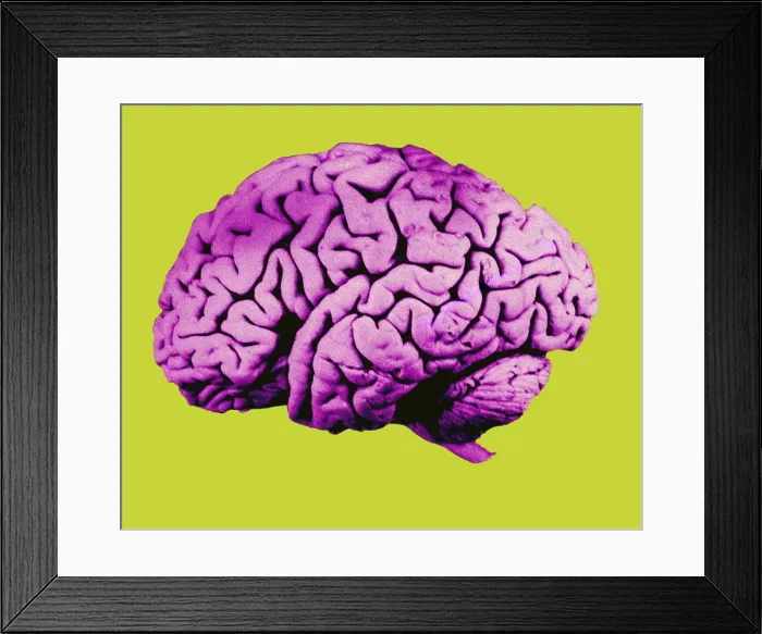 Framed Print : Human Brain Framed Print : Human Brain