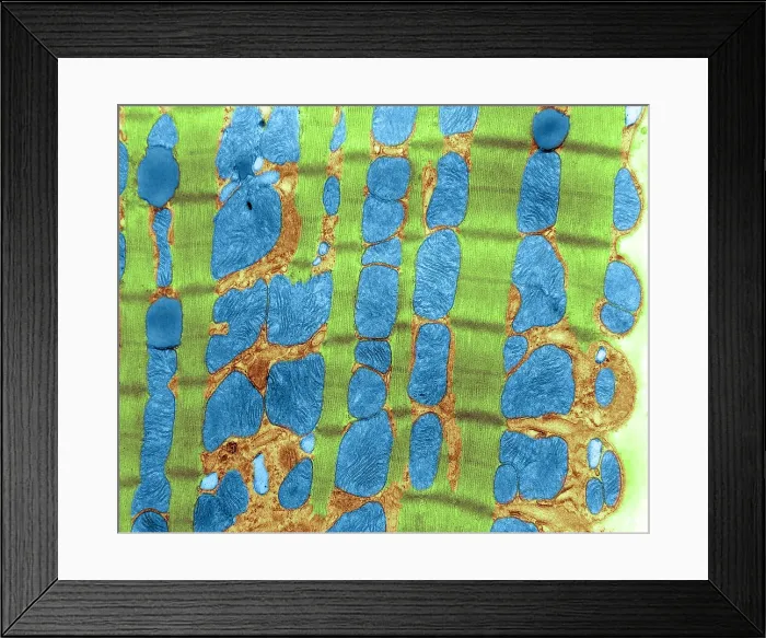 Framed Print : Cardiac Muscle, TEM Framed Print : Cardiac Muscle, TEM