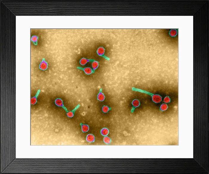 Framed Print : Rauscher Leukemia Virus, TEM
