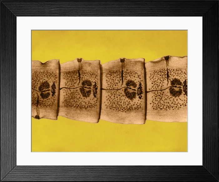 Framed Print : Dog Tapeworm under a microscope Framed Print : Dog Tapeworm under a microscope