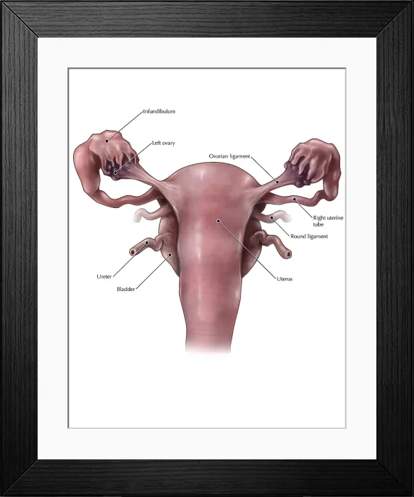 Framed Print : Uterus, Ovaries and Bladder (Posterior View) Framed Print : Uterus, Ovaries and Bladder (Posterior View)