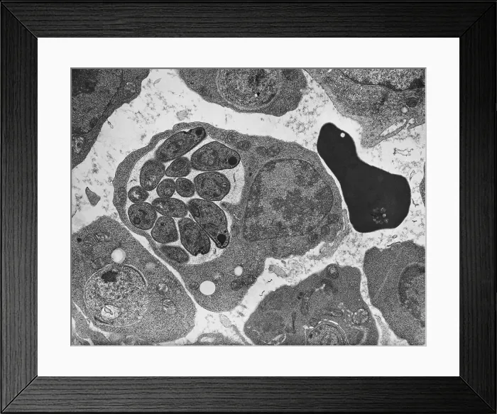 Framed Print : Malaria, Plasmodium cathemerium, TEM Framed Print : Malaria, Plasmodium cathemerium, TEM