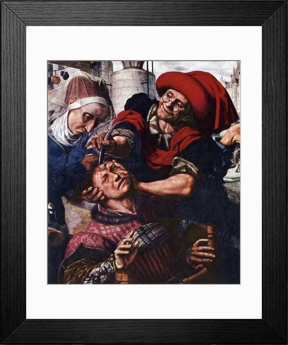 Framed Print : Barber-Surgeon Treating Head Injury, 16th Century Framed Print : Barber-Surgeon Treating Head Injury, 16th Century