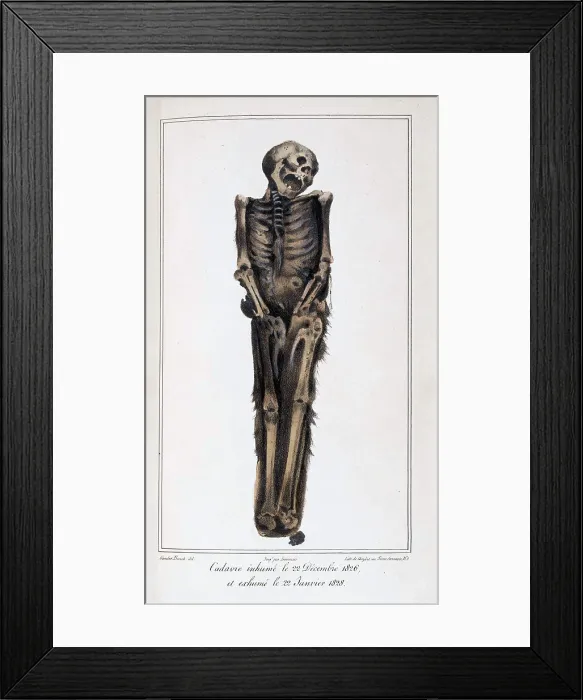 Framed Print : Mathieu Orfila, Decomposition On Exhumed Bodies, 1831